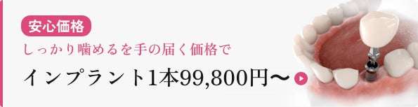 国内最大級「ALBA歯科」沖縄初進出 浦添パルコシティに4月開院 4 歯科用CTや口腔内スキャナーなどの高度な医療機器を導入